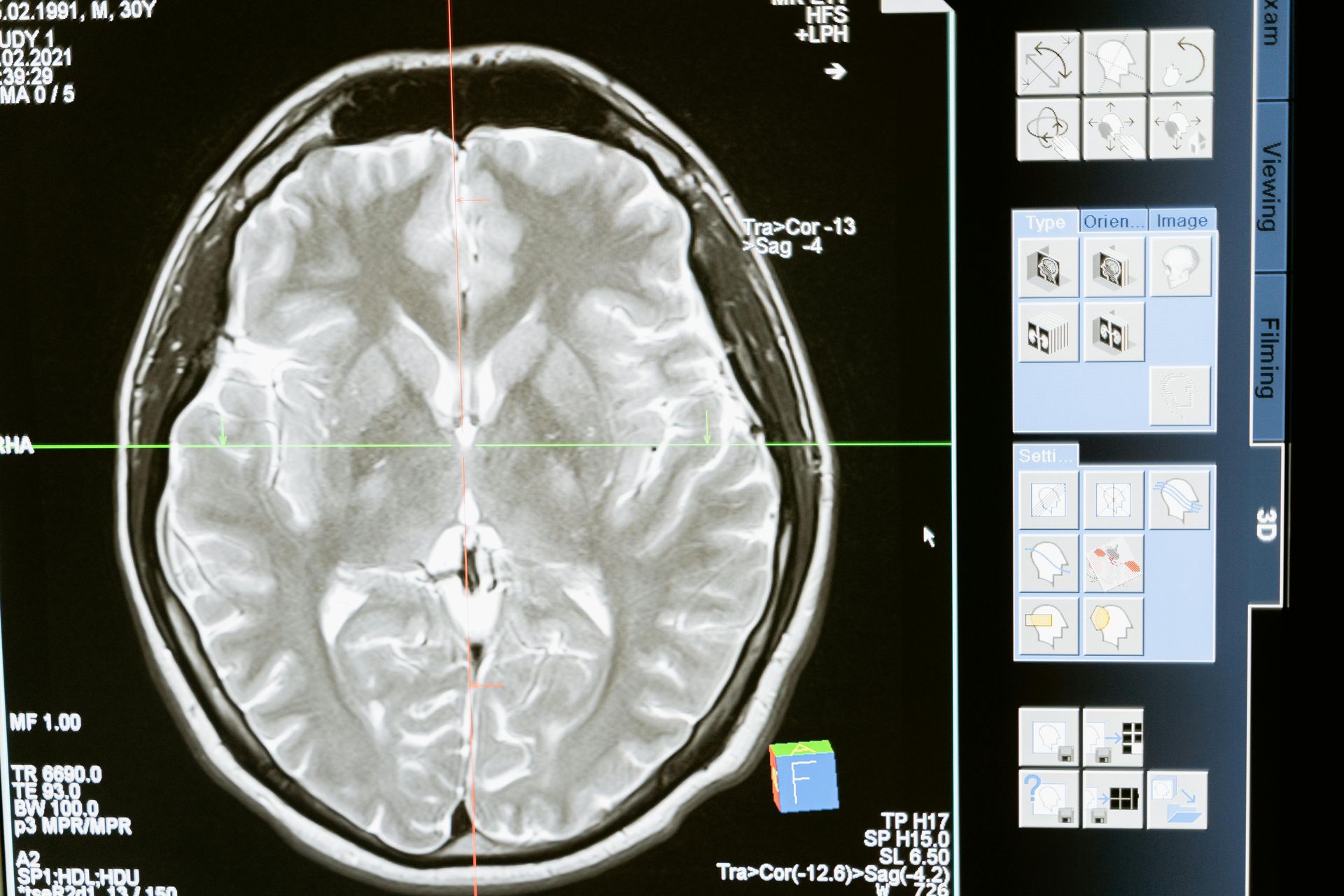 Brain Aging Decoded: How AI Links Lifestyle to a Younger, Healthier Mind