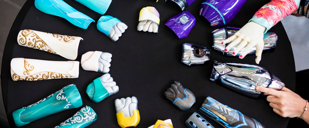 Personalized 3D-Printed Prosthetics Ready in Just 10 Hours